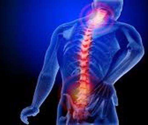Ankylosing Spondylitis 