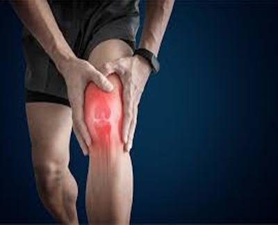 Arthritis