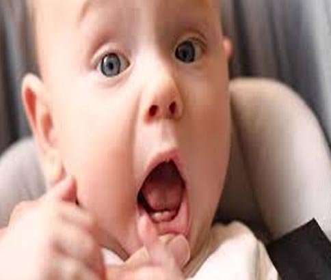 Delayed teething