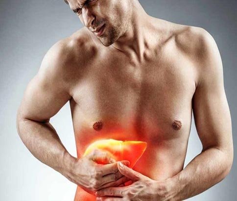 Fatty Liver