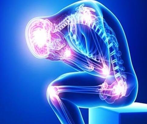 Fibromyalgia