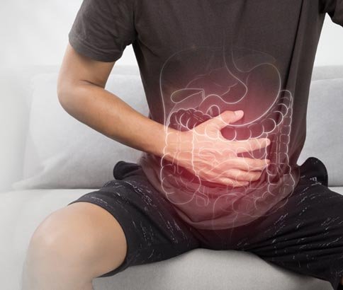 IBS ( Irritable Bowel Syndrome)