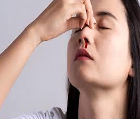 Nasal Bleeding