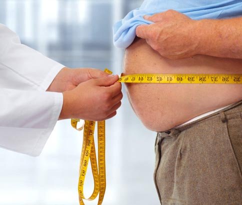 Obesity