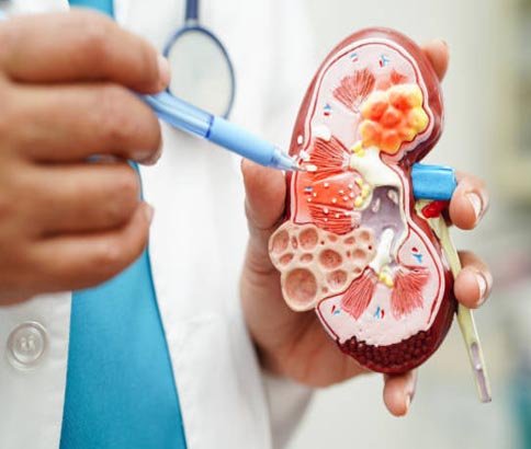 Renal  Infection