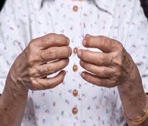Rheumatoid Arthritis