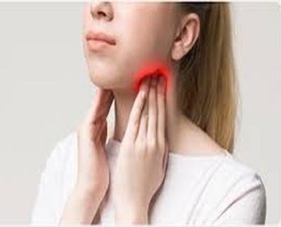 Tonsillitis