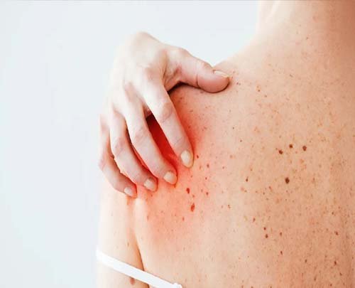 itching skin