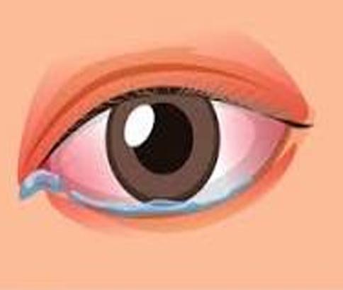 Watering of eyes